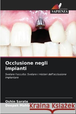 Occlusione negli impianti Oshin Sarate Deepak Mahla  9786206119869