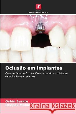 Oclusao em implantes Oshin Sarate Deepak Mahla  9786206119876