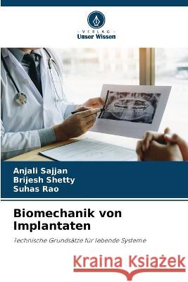 Biomechanik von Implantaten Anjali Sajjan Brijesh Shetty Suhas Rao 9786206137740