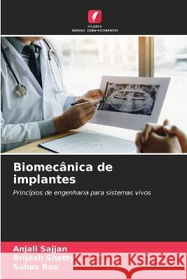 Biomecanica de implantes Anjali Sajjan Brijesh Shetty Suhas Rao 9786206137825