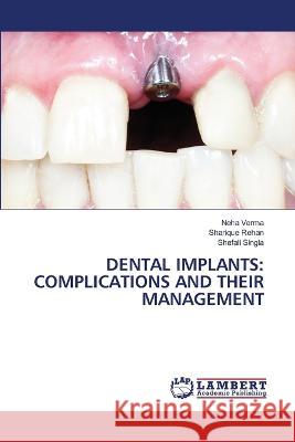 Dental Implants: Complications and Their Management Neha Verma Sharique Rehan Shefali Singla 9786206142119