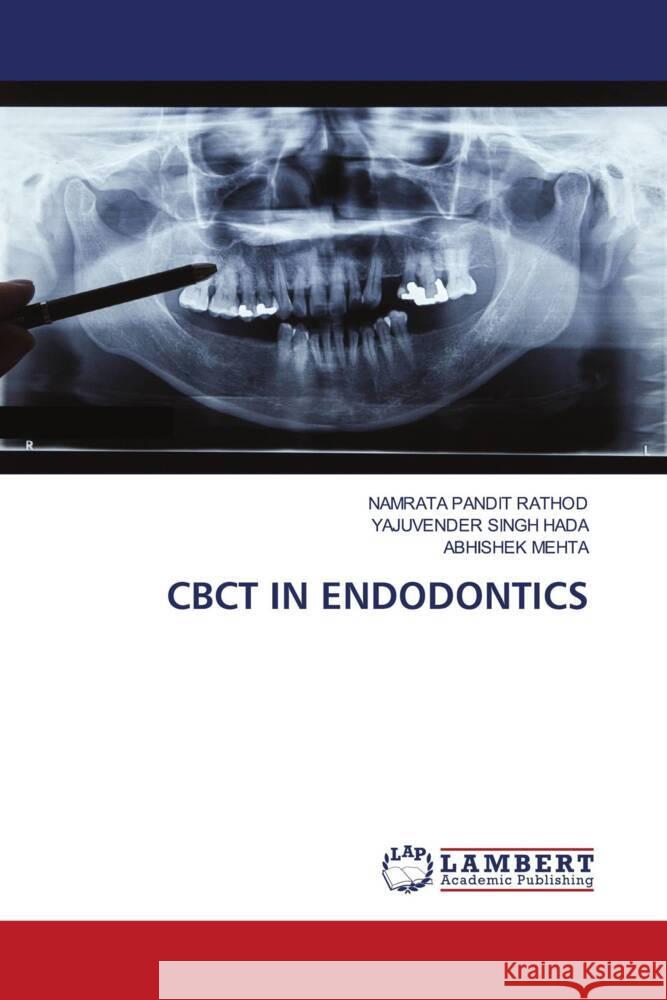 Cbct in Endodontics Namrata Pandi Yajuvender Singh Hada Abhishek Mehta 9786206142324 LAP Lambert Academic Publishing