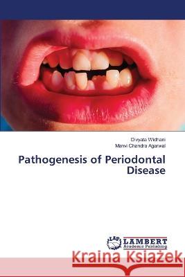 Pathogenesis of Periodontal Disease Widhani, Divyata, Agarwal, Manvi Chandra 9786206144670 LAP Lambert Academic Publishing