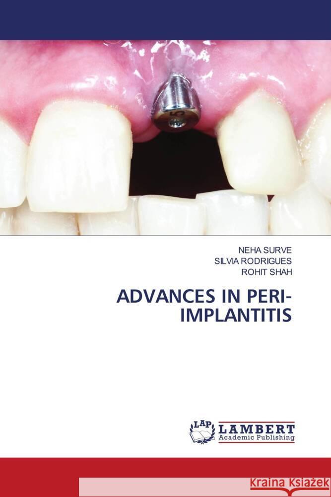 ADVANCES IN PERI-IMPLANTITIS SURVE, NEHA, Rodrigues, Silvia, Shah, Rohit 9786206145646