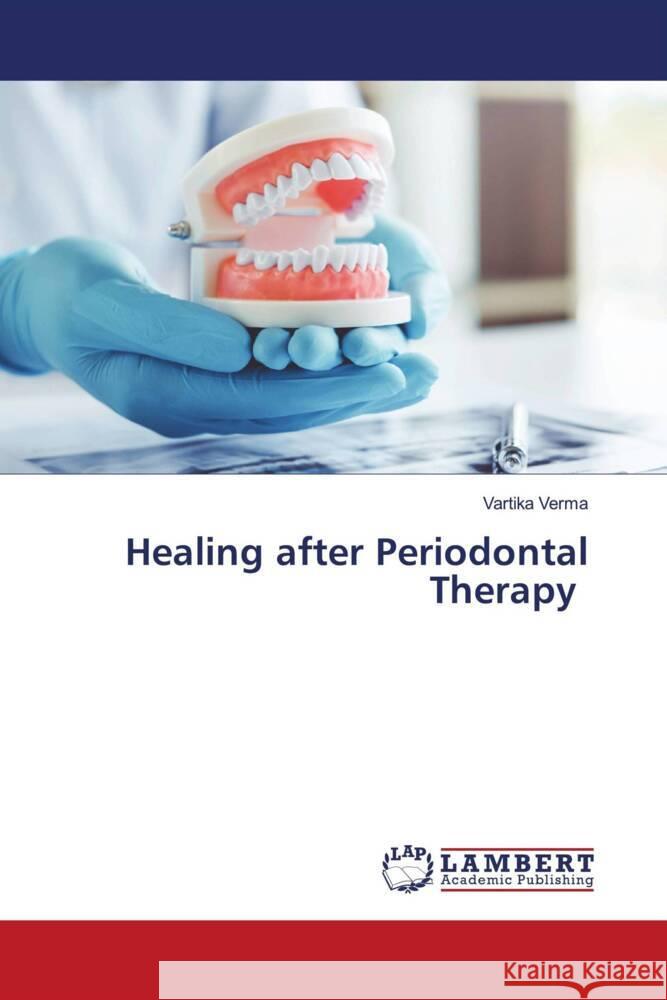 Healing after Periodontal Therapy Verma, Vartika 9786206146278