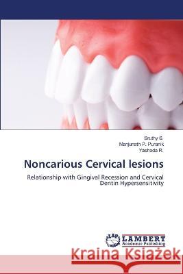 Noncarious Cervical lesions Sruthy S Manjunath P Yashoda R 9786206149644 LAP Lambert Academic Publishing