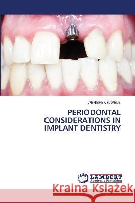 PERIODONTAL CONSIDERATIONS IN IMPLANT DENTISTRY KAMBLE, ABHISHEK 9786206152996