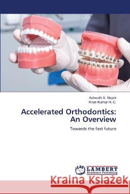 Accelerated Orthodontics: An Overview Nayak, Ashwath S., Kumar H. C., Kiran 9786206153399 LAP Lambert Academic Publishing
