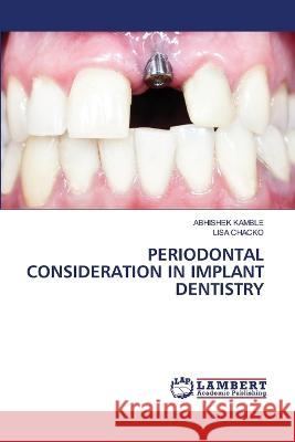 PERIODONTAL CONSIDERATION IN IMPLANT DENTISTRY KAMBLE, ABHISHEK, Chacko, Lisa 9786206155799