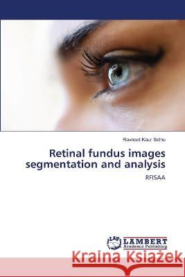 Retinal fundus images segmentation and analysis Sidhu, Ravneet Kaur 9786206157991