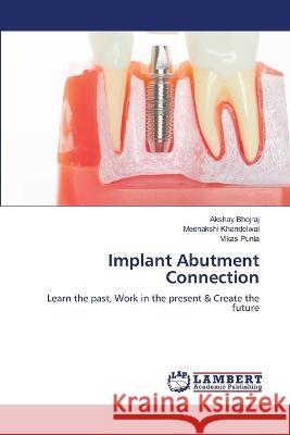 Implant Abutment Connection Bhojraj, Akshay, Khandelwal, Meenakshi, Punia, Vikas 9786206158530 LAP Lambert Academic Publishing