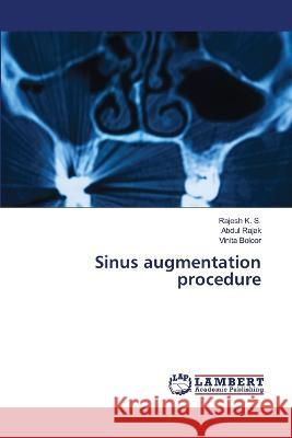 Sinus augmentation procedure K. S., Rajesh, Rajak, Abdul, Boloor, Vinita 9786206158585 LAP Lambert Academic Publishing