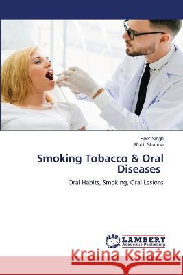 Smoking Tobacco & Oral Diseases Singh, Beer, Sharma, Rohit 9786206159810