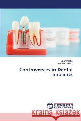 Controversies in Dental Implants Chacko, Lisa, Dalve, Deveshri 9786206160267