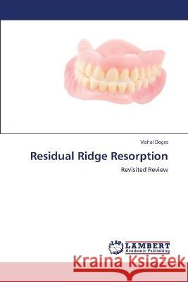 Residual Ridge Resorption Dogra, Vishal 9786206161936