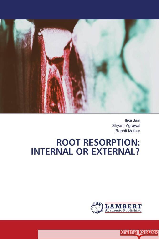 ROOT RESORPTION: INTERNAL OR EXTERNAL? Jain, Itika, Agrawal, Shyam, Mathur, Rachit 9786206163022