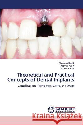 Theoretical and Practical Concepts of Dental Implants Saeidi, Nastaran, Nasiri, Kamyar, Arabi, Ali Reza 9786206164616 LAP Lambert Academic Publishing