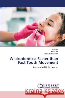 Wilckodontics: Faster than Fast Tooth Movement Vivek, Vir, Pal, Ankita, Shamsi, Shah Zafar 9786206165415