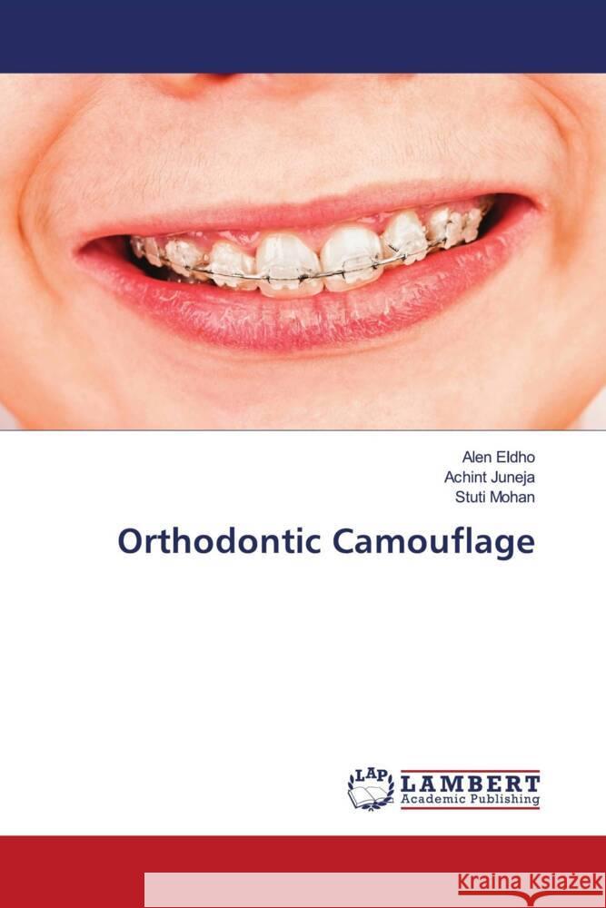 Orthodontic Camouflage Eldho, Alen, JUNEJA, ACHINT, Mohan, Stuti 9786206166306