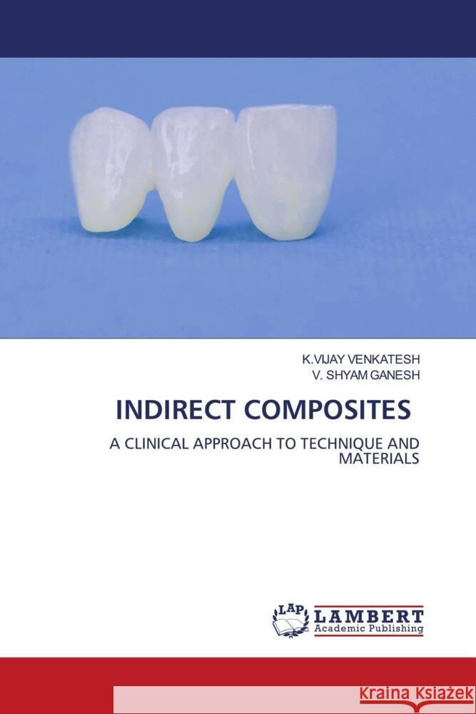 INDIRECT COMPOSITES VENKATESH, K.VIJAY, GANESH, V. SHYAM 9786206172789