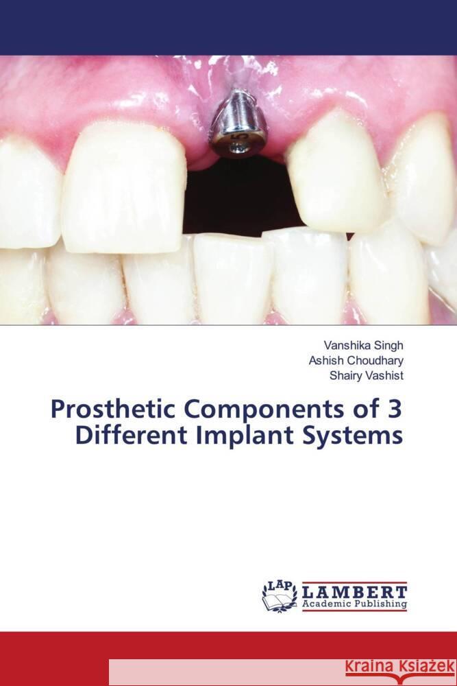 Prosthetic Components of 3 Different Implant Systems Singh, Vanshika, Choudhary, Ashish, Vashist, Shairy 9786206182078 LAP Lambert Academic Publishing