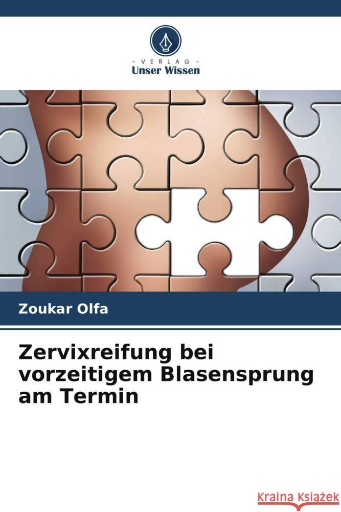 Zervixreifung bei vorzeitigem Blasensprung am Termin Zoukar Olfa   9786206198161