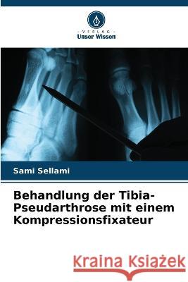 Behandlung der Tibia-Pseudarthrose mit einem Kompressionsfixateur Sami Sellami   9786206209911