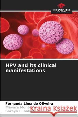 HPV and its clinical manifestations Fernanda Lima de Oliveira Mayara Monteiro Soraya El Hakim 9786206233534