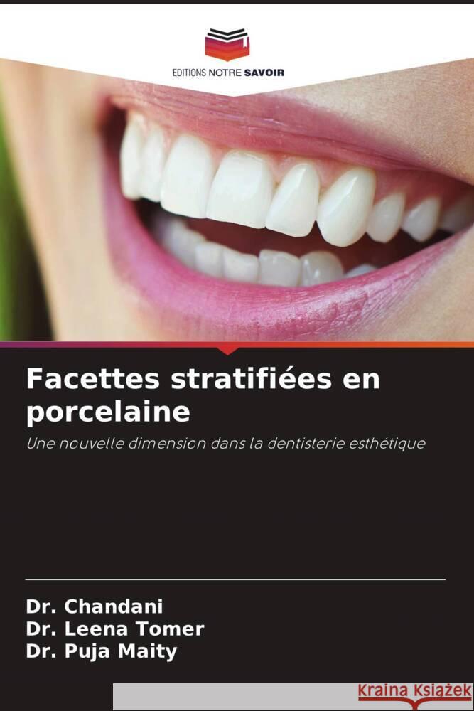 Facettes stratifiees en porcelaine Dr Chandani Dr Leena Tomer Dr Puja Maity 9786206246794