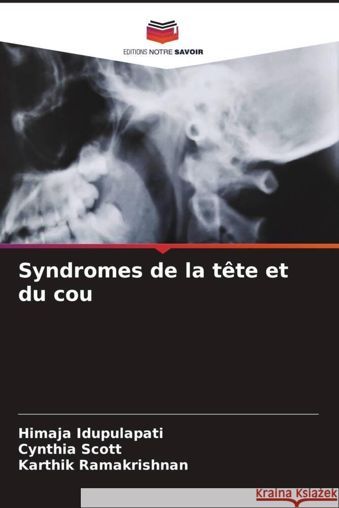 Syndromes de la tete et du cou Himaja Idupulapati Cynthia Scott Karthik Ramakrishnan 9786206247739