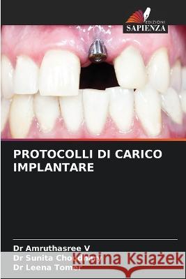 Protocolli Di Carico Implantare Dr Amruthasree V Dr Sunita Choudhary Dr Leena Tomer 9786206247760 Edizioni Sapienza