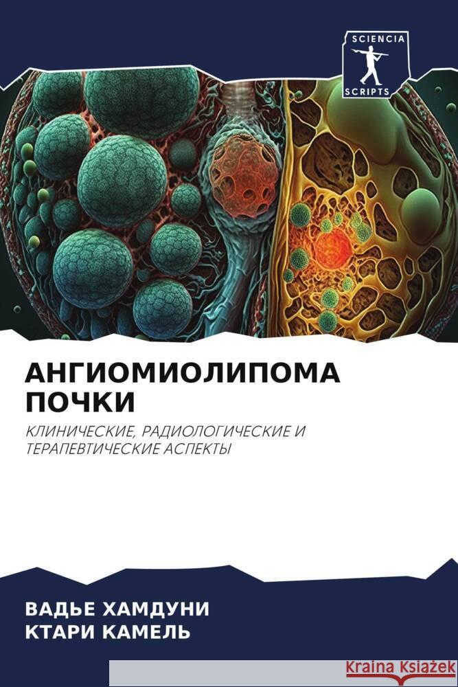 ANGIOMIOLIPOMA POChKI HAMDUNI, VAD'E, KAMEL', KTARI 9786206249252