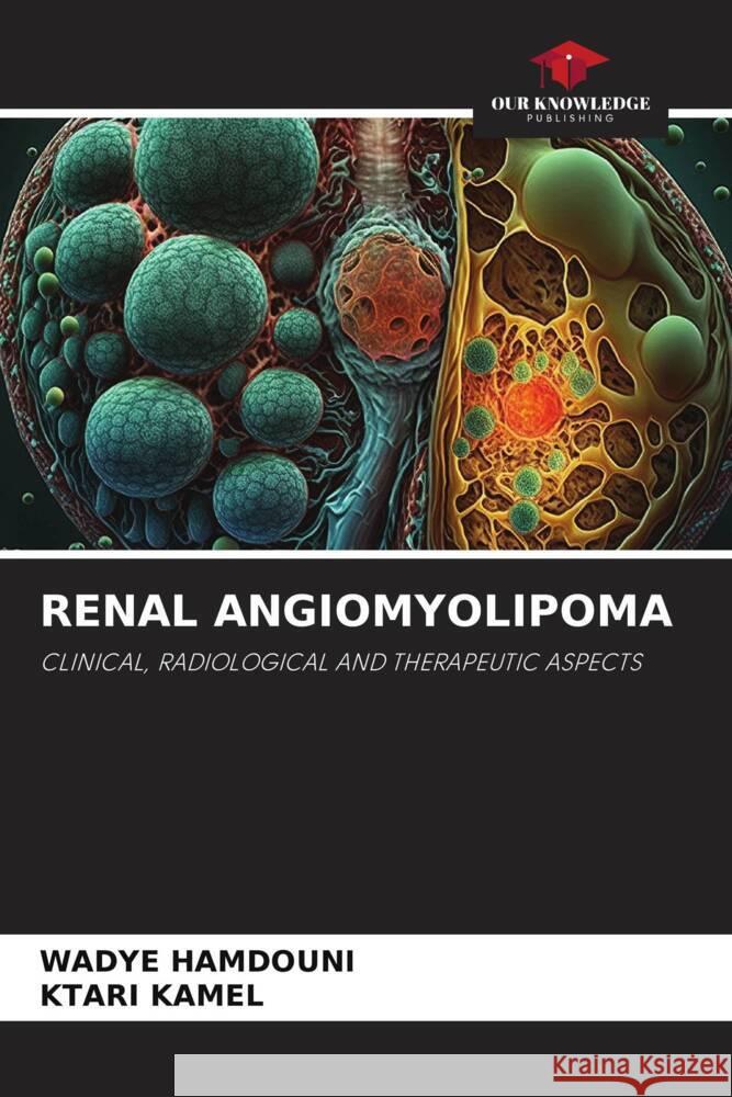 Renal Angiomyolipoma Wadye Hamdouni Ktari Kamel  9786206251682