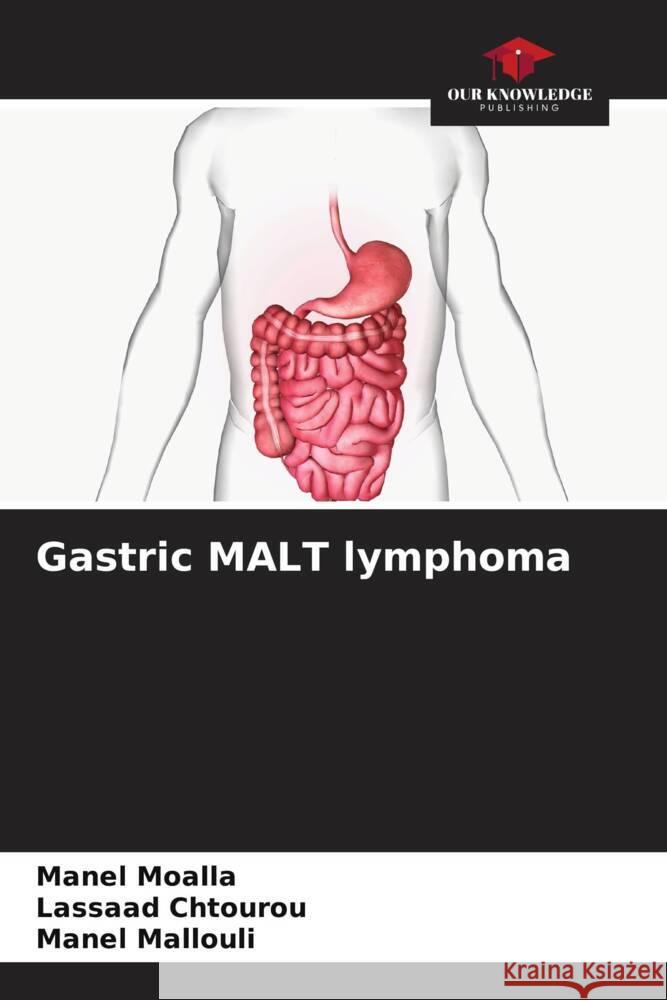 Gastric MALT lymphoma MOALLA, Manel, Chtourou, Lassaad, Mallouli, Manel 9786206258667