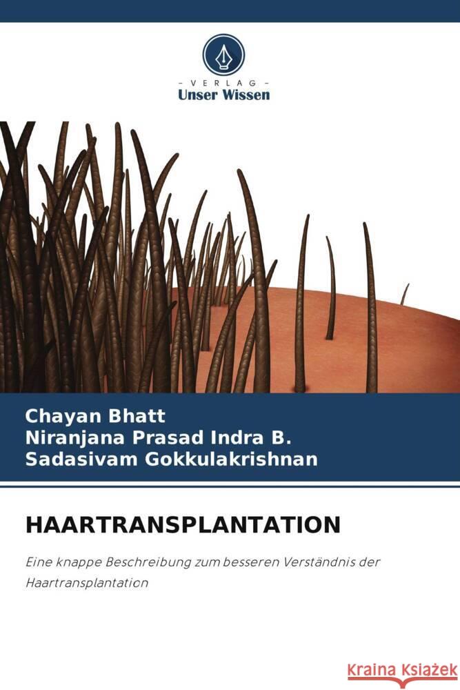 HAARTRANSPLANTATION Bhatt, Chayan, Indra B., Niranjana Prasad, Gokkulakrishnan, Sadasivam 9786206273547