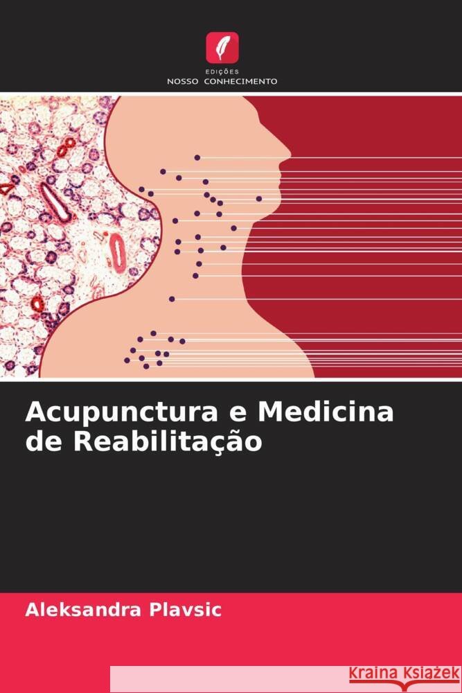 Acupunctura e Medicina de Reabilitação Plavsic, Aleksandra 9786206275008