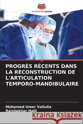 Progres Recents Dans La Reconstruction de l'Articulation Temporo-Mandibulaire Mohamed Umer Valiulla Rajshekhar Halli  9786206279273