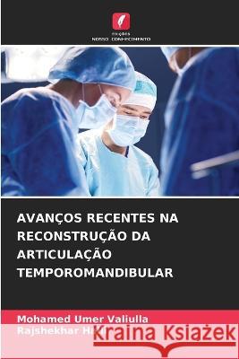 Avancos Recentes Na Reconstrucao Da Articulacao Temporomandibular Mohamed Umer Valiulla Rajshekhar Halli  9786206279297