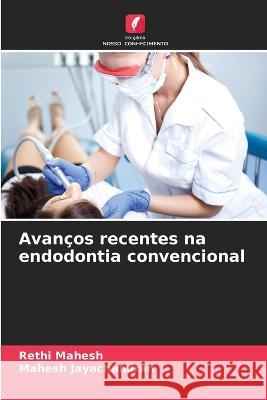 Avancos recentes na endodontia convencional Rethi Mahesh Mahesh Jayachandran  9786206280699