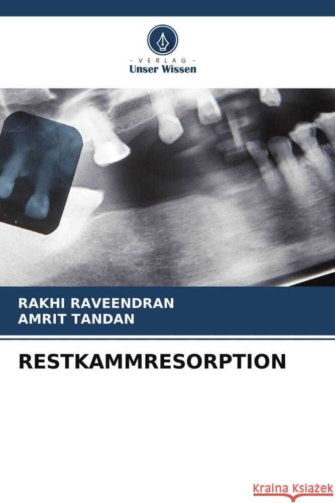 RESTKAMMRESORPTION RAVEENDRAN, RAKHI, Tandan, Amrit 9786206293279