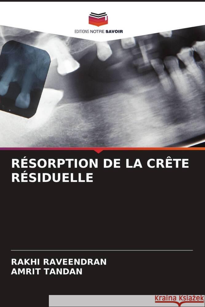 RÉSORPTION DE LA CRÊTE RÉSIDUELLE RAVEENDRAN, RAKHI, Tandan, Amrit 9786206293293