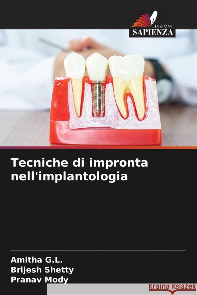 Tecniche di impronta nell'implantologia G.L., Amitha, Shetty, Brijesh, Mody, Pranav 9786206300120