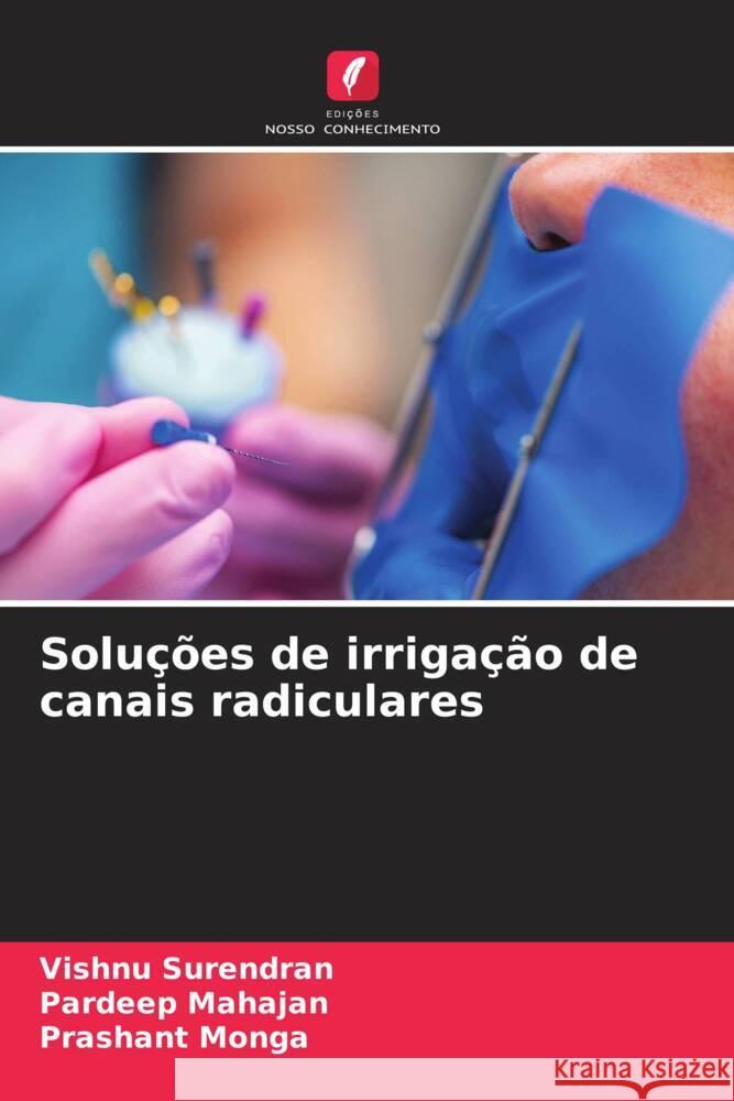 Soluções de irrigação de canais radiculares Surendran, Vishnu, Mahajan, Pardeep, Monga, Prashant 9786206302193