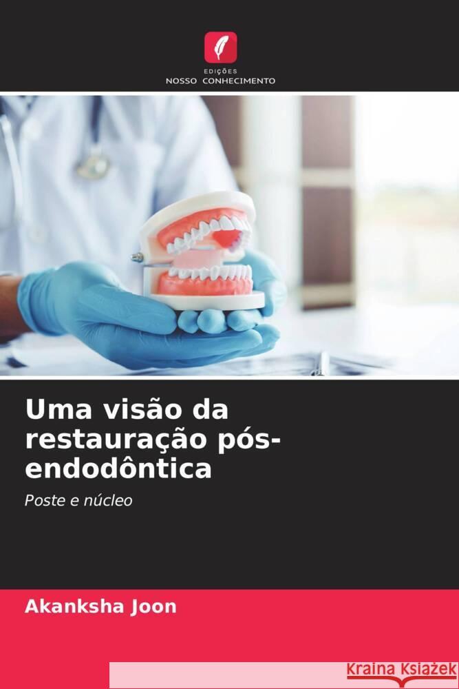 Uma visão da restauração pós-endodôntica Joon, Akanksha 9786206303732