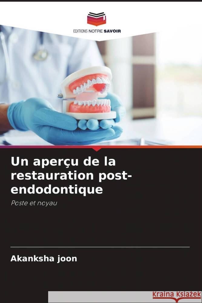 Un aperçu de la restauration post-endodontique Joon, Akanksha 9786206303763