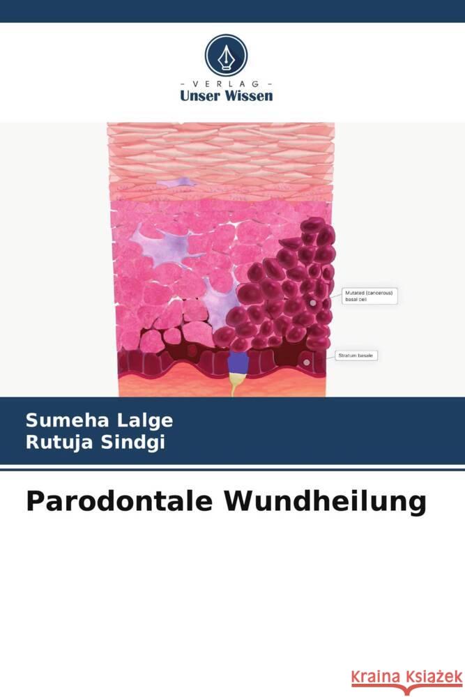 Parodontale Wundheilung LALGE, SUMEHA, SINDGI, RUTUJA 9786206306863 Verlag Unser Wissen