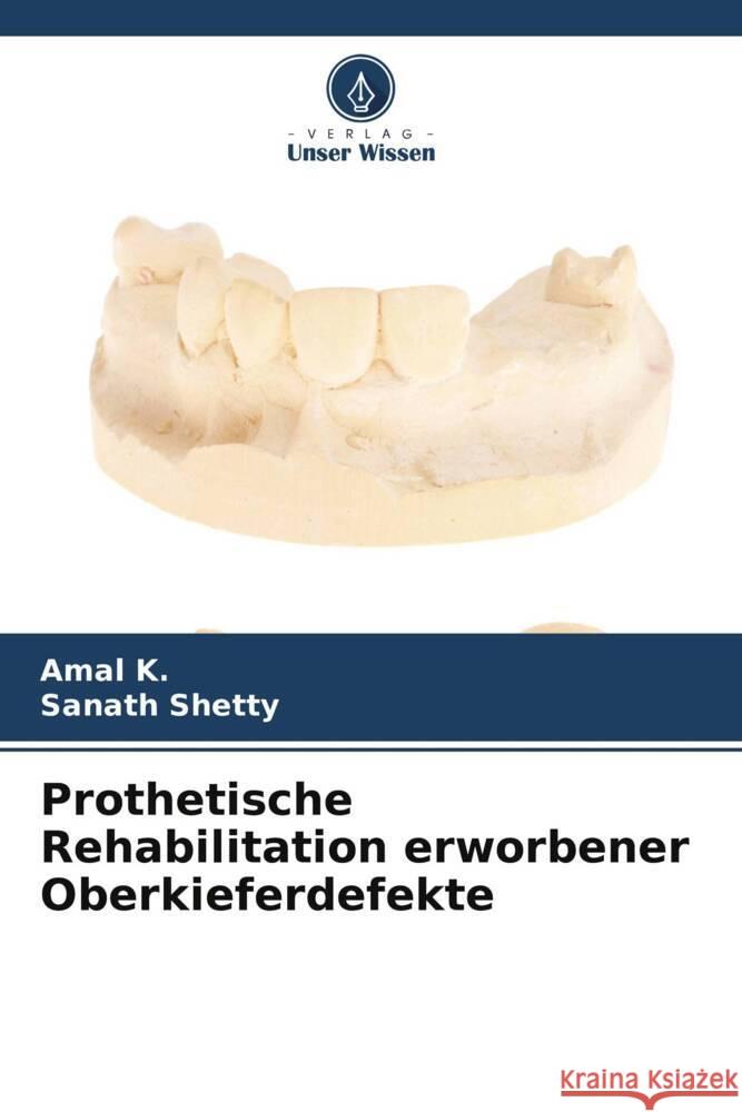 Prothetische Rehabilitation erworbener Oberkieferdefekte K., Amal, Shetty, Sanath 9786206322238