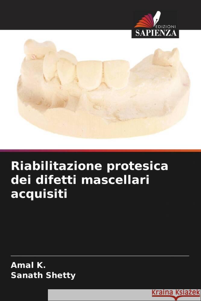 Riabilitazione protesica dei difetti mascellari acquisiti K., Amal, Shetty, Sanath 9786206322504