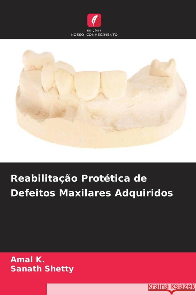 Reabilitação Protética de Defeitos Maxilares Adquiridos K., Amal, Shetty, Sanath 9786206322511