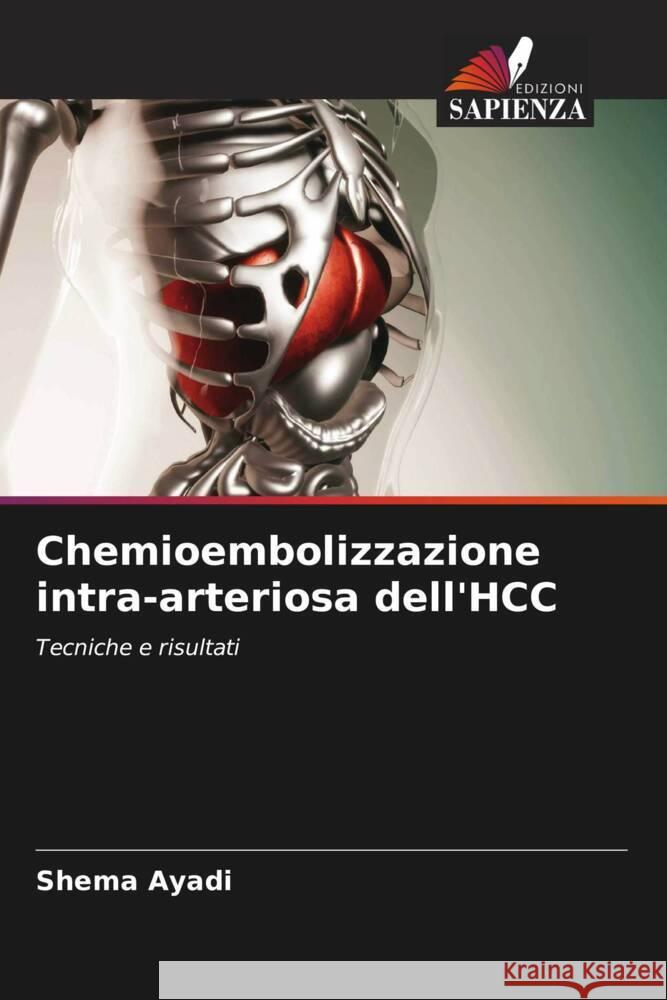 Chemioembolizzazione intra-arteriosa dell'HCC Ayadi, Shema 9786206325321 Edizioni Sapienza